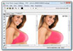 Virtual Plastic Surgery Software (VPSS)