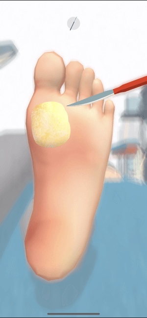 Điều trị các vấn đề về chân cho bệnh nhân