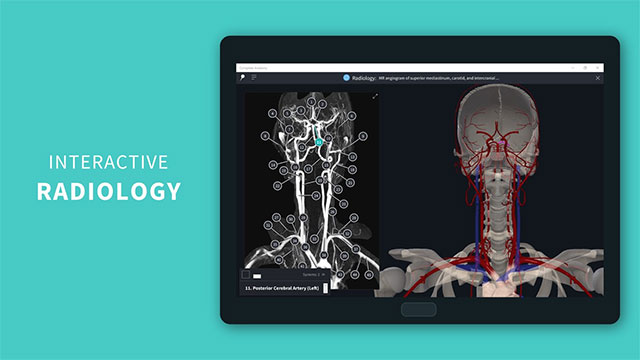 Complete Anatomy 2021 liên tục cập nhật tính năng mới, cải tiến và sửa lỗi