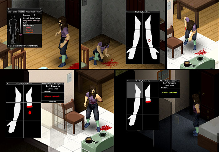 Có rất nguyên nhân khiến nhân vật gặp chấn thương trong Project Zomboid